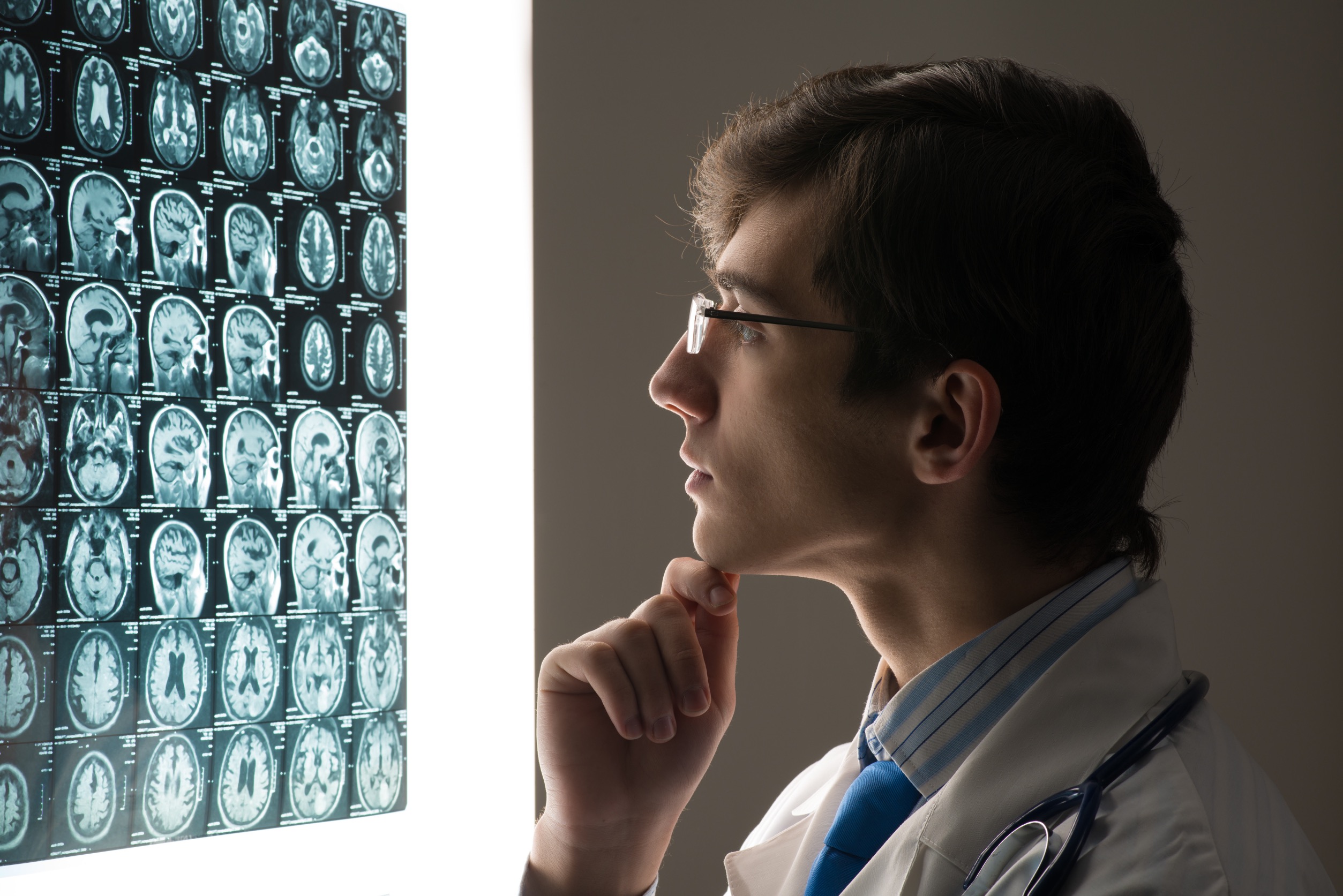 Automatisierte quantitative Pupillometrie mit dem NPi-300 Pupillometer: Neurologischer Pupillenindex (NPi) als Indikator für neurologische Verschlechterung bei Schlaganfall 