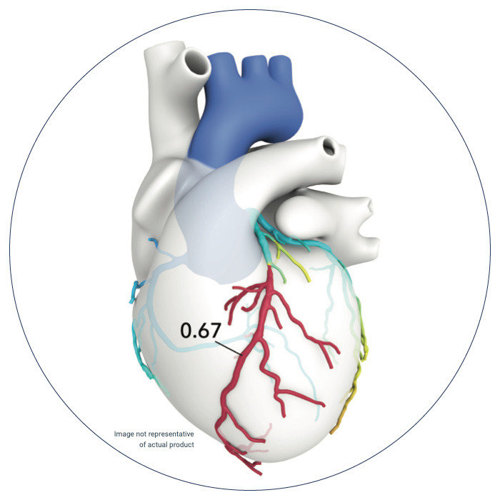 HearFlow