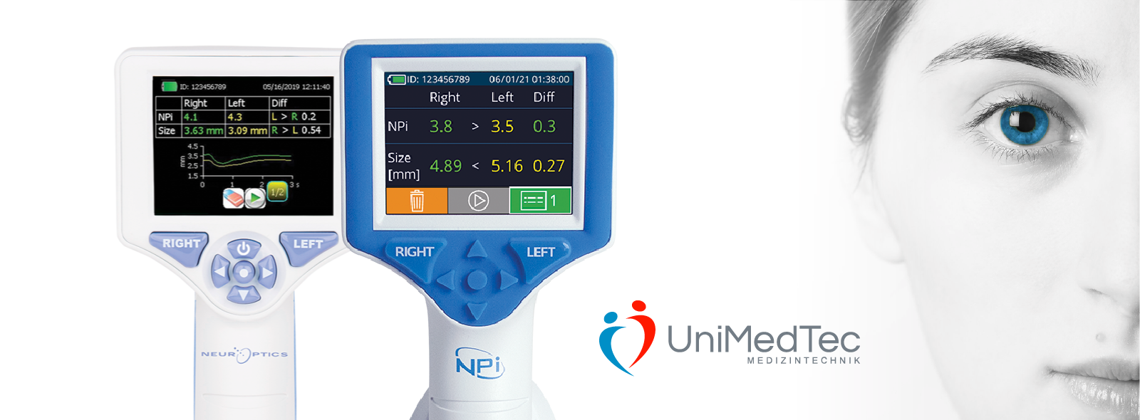 Vergleich NPi 200 und NPi 300 Pupillometer